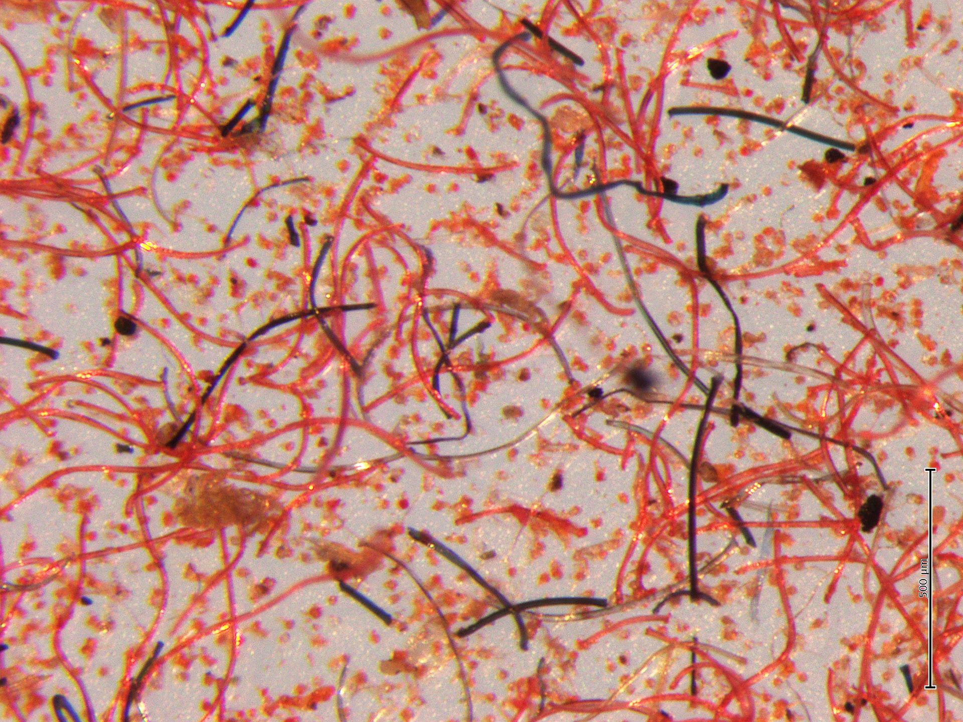 Les lessives libèrent des milliards de microfibres de plastique